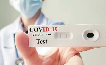 Κ.Υ. για δωρεάν τεστ Covid-19. Χρήσιμες πληροφορίες από τον Σύλλογο Ρ. Ιμβριώτη