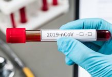 Εγκρίθηκε τεστ κορωνοϊού για διάγνωση κατ’ οίκον