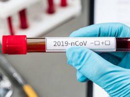 Εγκρίθηκε τεστ κορωνοϊού για διάγνωση κατ’ οίκον