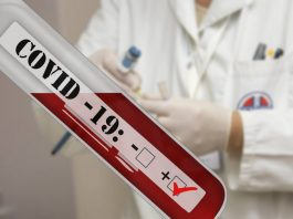 Δειγματοληπτικός δωρεάν έλεγχος COVID-19