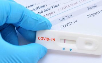 Δωρεάν τεστ κορωνοϊού για εργαζομένους σε επιχειρήσεις άνω των 20 υπαλλήλων