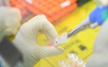 Κορωνοϊός: Θεραπεία με ελληνική σφραγίδα πήρε έγκριση από τον ΕΜΑ και χορηγείται στα νοσοκομεία