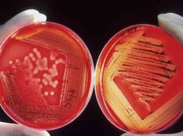 Ο λόγος που ο Candida Auris τρομάζει πολύ περισσότερο απ’ τον κορωνοϊό