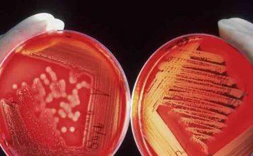 Ο λόγος που ο Candida Auris τρομάζει πολύ περισσότερο απ’ τον κορωνοϊό