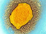 ΕΟΔΥ: Το πρώτο ύποπτο κρούσμα «Ευλογιάς των πιθήκων στη χώρα μας»