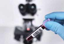 Προειδοποίηση ειδικών: Έρχεται «τσουνάμι» καρκίνων παγκοσμίως