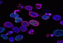 Πώς δρα το επαναστατικό φάρμακο που σκοτώνει τους καρκινικούς όγκους