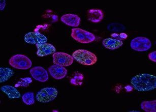 Πώς δρα το επαναστατικό φάρμακο που σκοτώνει τους καρκινικούς όγκους
